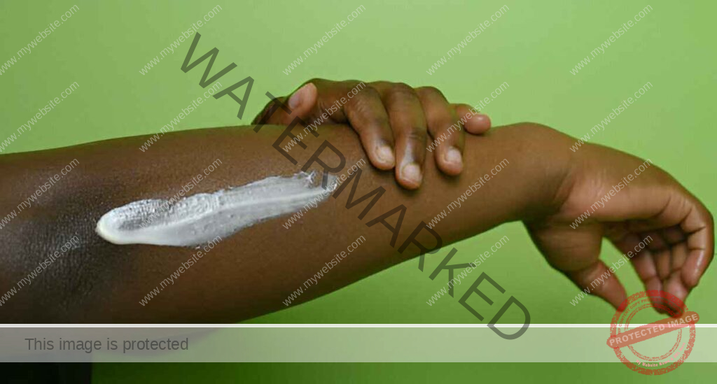 Skin lightening cream in Nigeria
